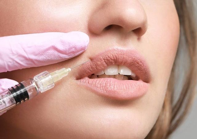 Lip Botox: Modern Beauty with Minimal Effort