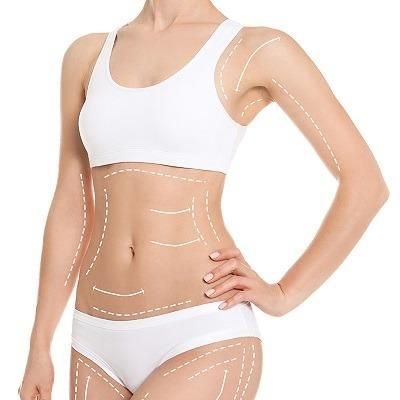 Liposuction and Weight Management: What You Need to Know