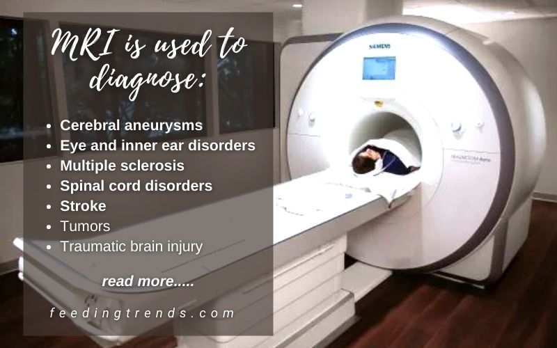 MRI Scan And All Details About It