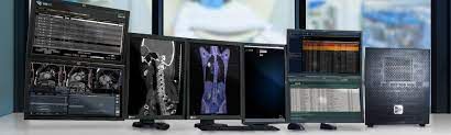 Medical Imaging Workstation Market Key Players Analysis Report 
