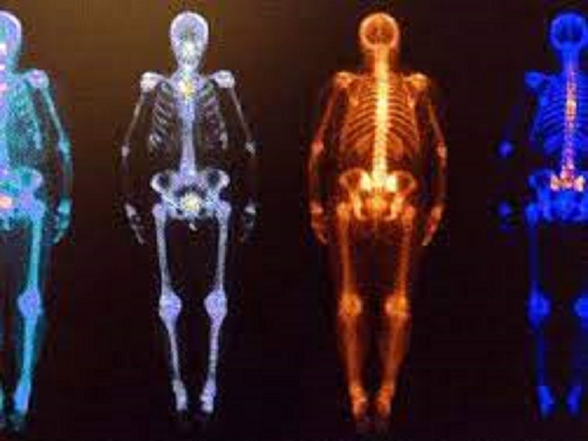 Medical Isotopes Market Share & Latest Trades Report to 2028
