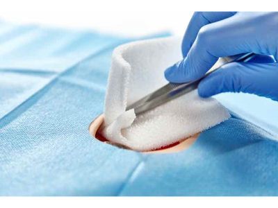 Medical Non-Woven Disposables Market: Analysis, Size, Share 2030