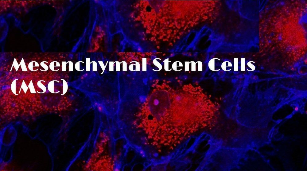 Mesenchymal Stem Cells Market Opportunities & Forecast to 2028
