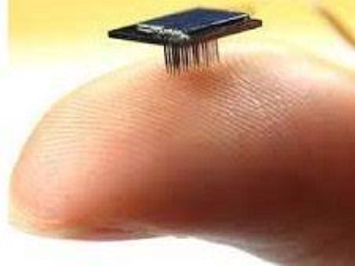 Micro-Electronic Medical Implants Market Size, Status, Growth