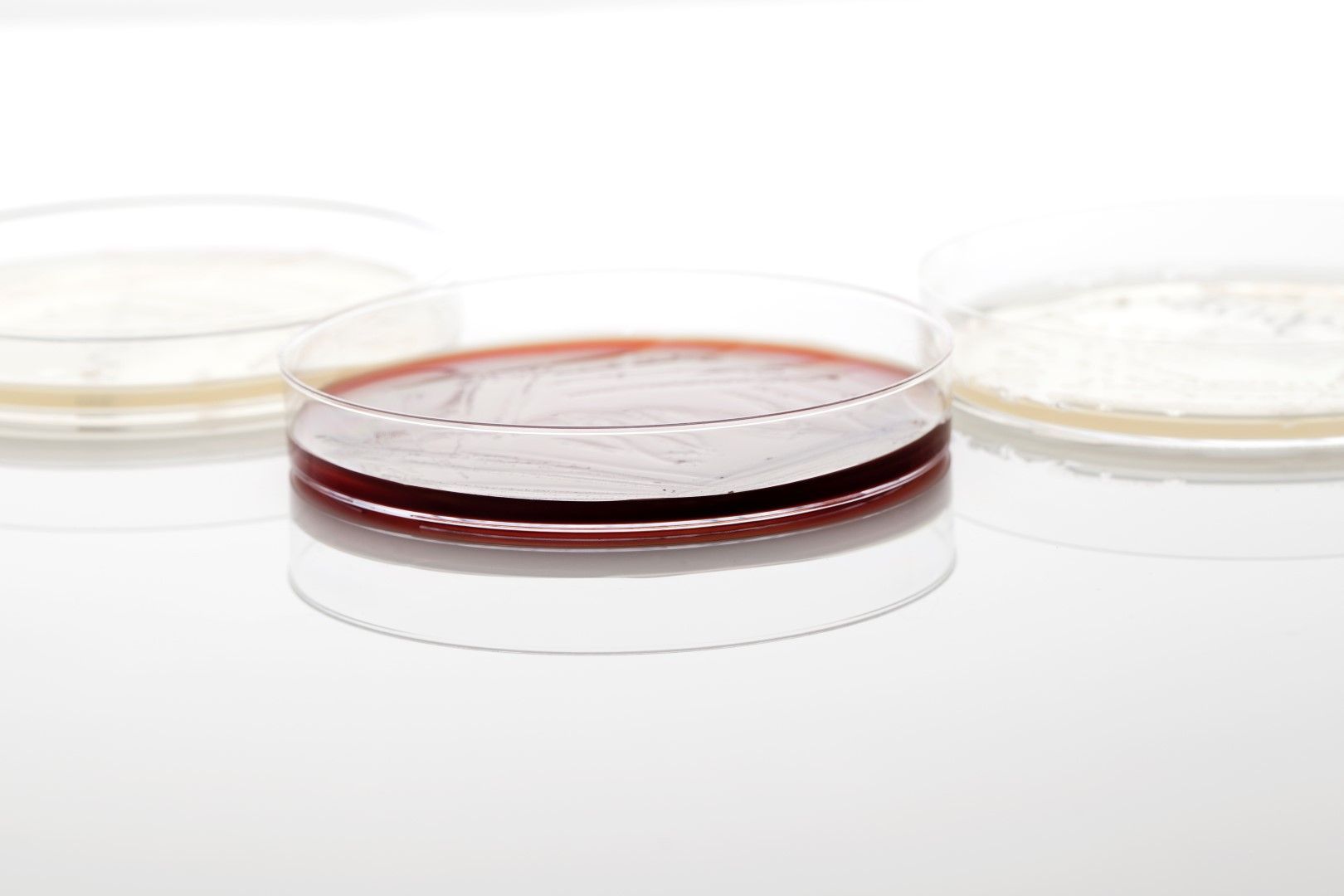 Microbial Identification Market Size 2021–2028