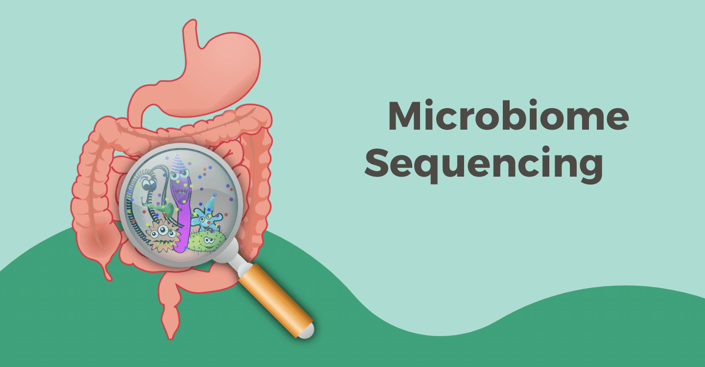 Microbiome Sequencing Services Market 2022 Industry Analysis 2028
