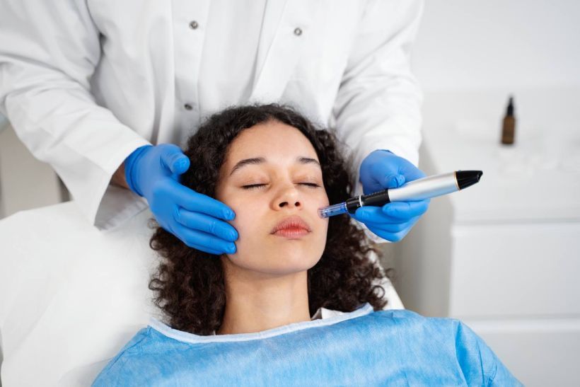 How Microneedling Treatments Help Improve Skin in Toronto