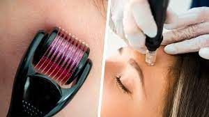 Microneedling Market Size, In-Depth Analysis Report