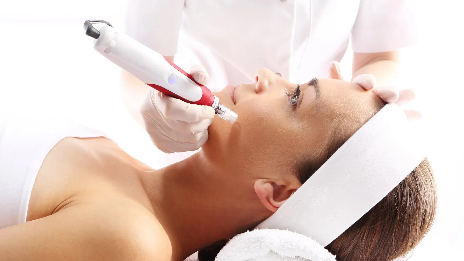 Microneedling for Hyperpigmentation: Your Path to Even Skin Tone in Islamabad