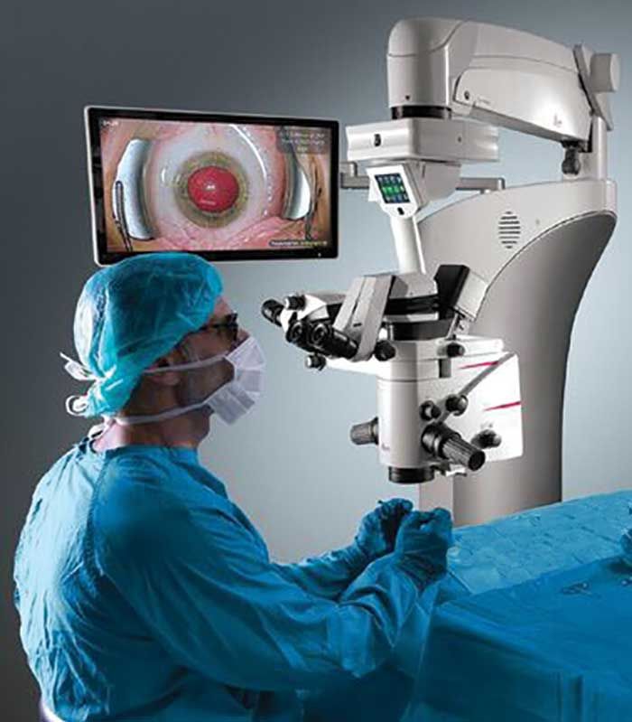 Surgical Microscope Market,forecast 2023-2029
