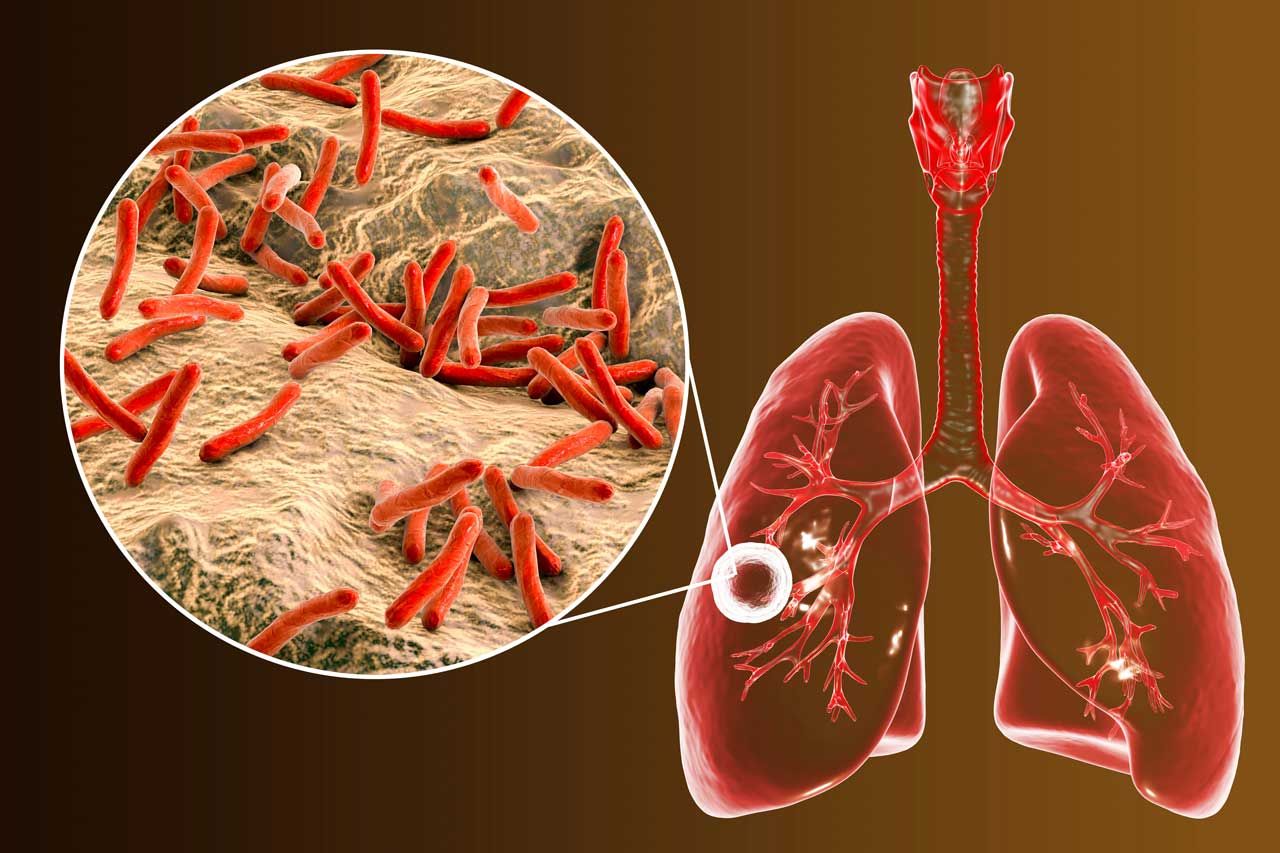 Mycobacterium Tuberculosis Testing Market Trends Report to 2028