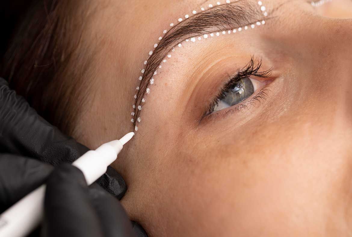 FUE for Eyebrows, A Modern Hair Transplant Method