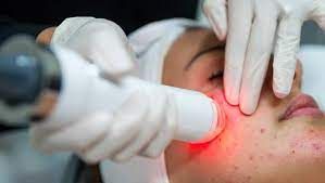 Non-Invasive Aesthetic Treatment Market Outlook to 2028
