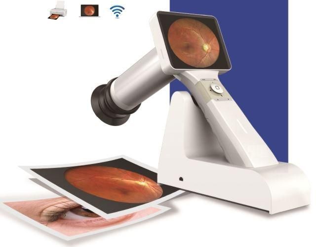 Nonmydriatic Handheld Fundus Cameras Market Research Report 2022
