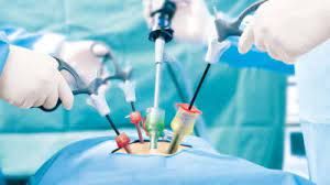 Obesity Treatment Surgery Devices Market Growth Analysis Report