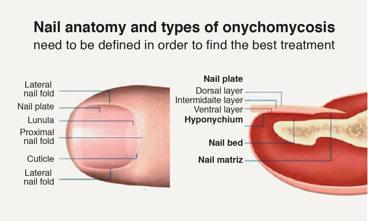 Onychomycosis Treatment Industry Analysis Report 2022-2028