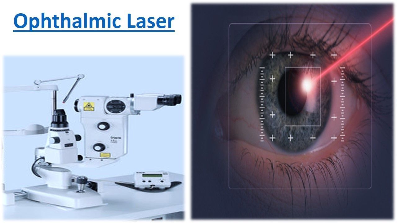 Ophthalmic Lasers Market Size, Share, Regional Overview 2028