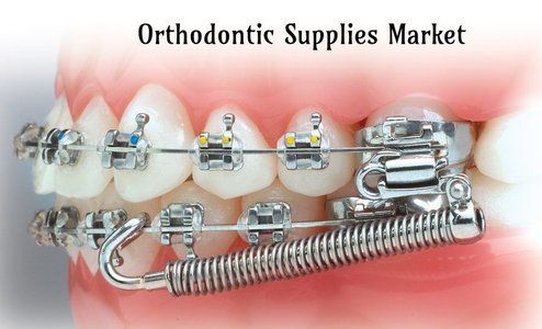 Orthodontic Consumables Market 2022 - Top Key Players Analysis