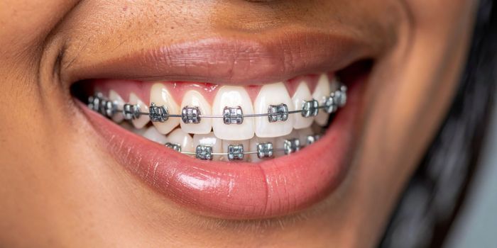 Orthodontist in Gurgaon: Transforming Smiles at Gupta Dental Clinic