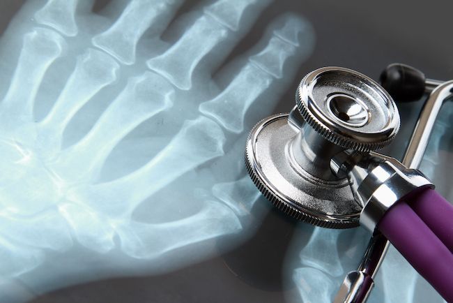 Orthopedic 3d Printing Equipment Market Forecast 2022-2028