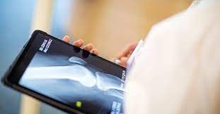 Osteoarthritis Therapeutics Market Regional Overview & Forecast
