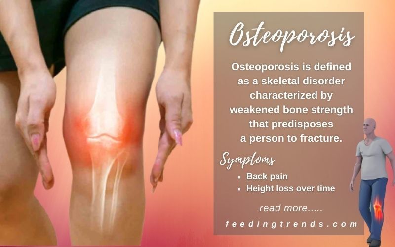 Osteoporosis Symptoms, Causes & Preventions That You Should Know