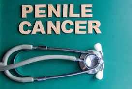 Penile Cancer Treatment Market Status, Growth | Industry Analysis