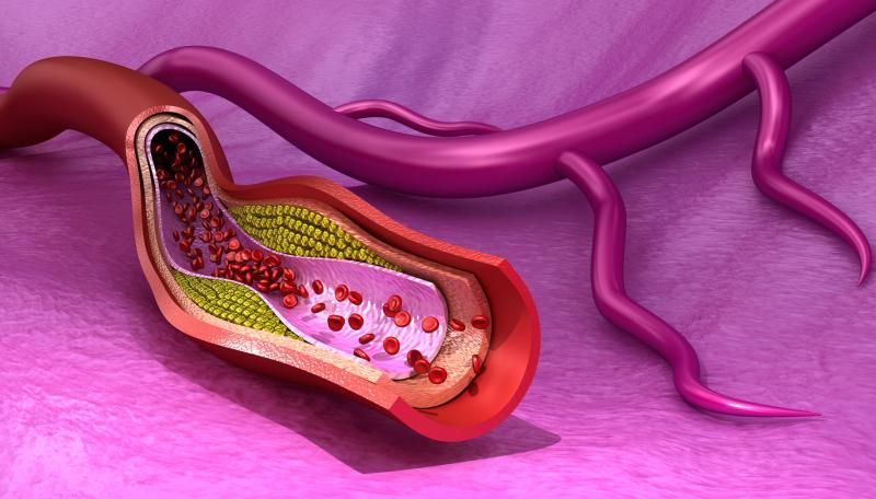Peripheral Artery Revascularisation Market Share Report to 2028