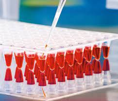 Polymerase Chain Reaction Market Size, Growth, Opportunities