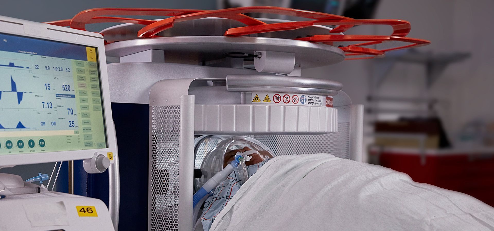 Portable Mri Market Latest Analysis Report Upto 2028