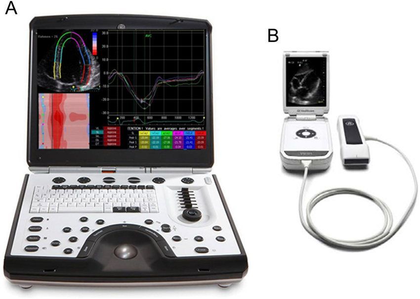 Portable Ultrasound Devices Market Opportunities and  Forecast 
