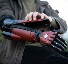 Prosthetic Arm Market Report, Latest Trends, Industry Opportunity