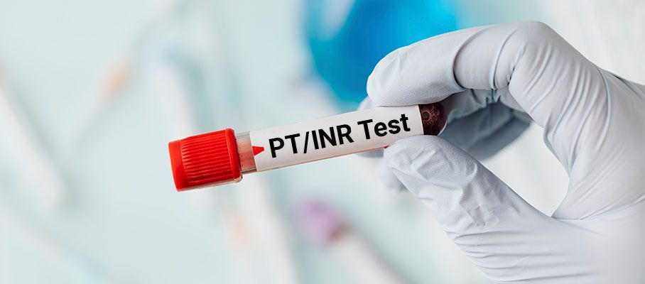 Prothrombin Time Testing Market Latest Trades Report to 2028