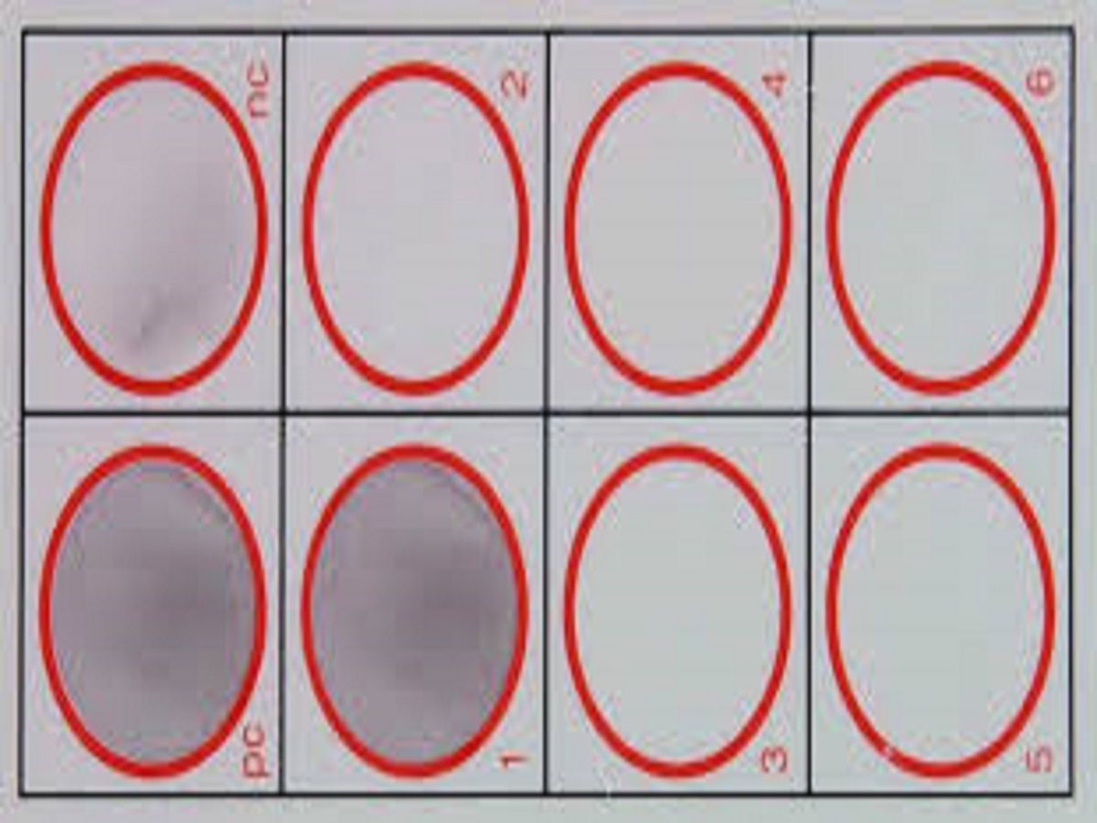 Rapid Plasma Reagin Test Market Outlook to 2028