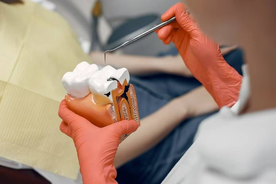 What Is Root Canal: Everything About Root Canal Treatment