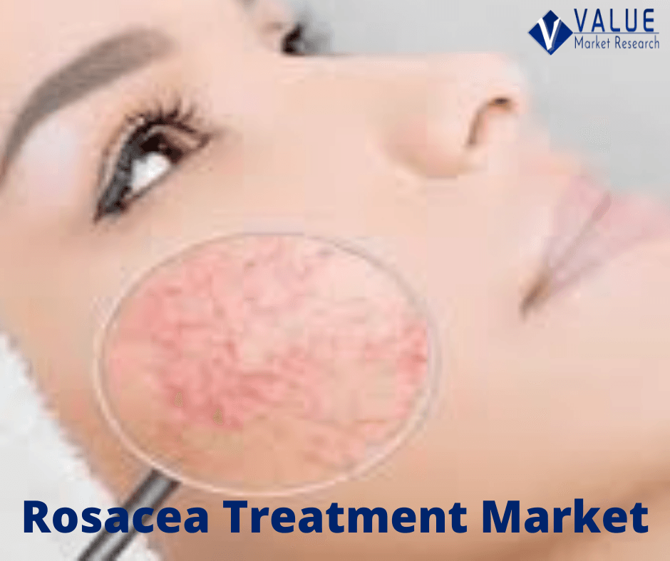 Rosacea Treatment Market Growth | Research Report, 2028