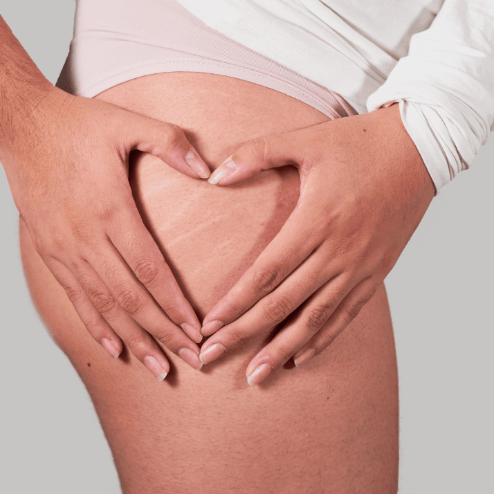 How to Maintain Results After Scar Camouflage Treatment