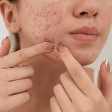 Scar Removal in Dubai for Advanced Skin Healing and Smooth Texture