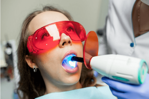 Benefits of Choosing New Ivory for Teeth Whitening in Dubai