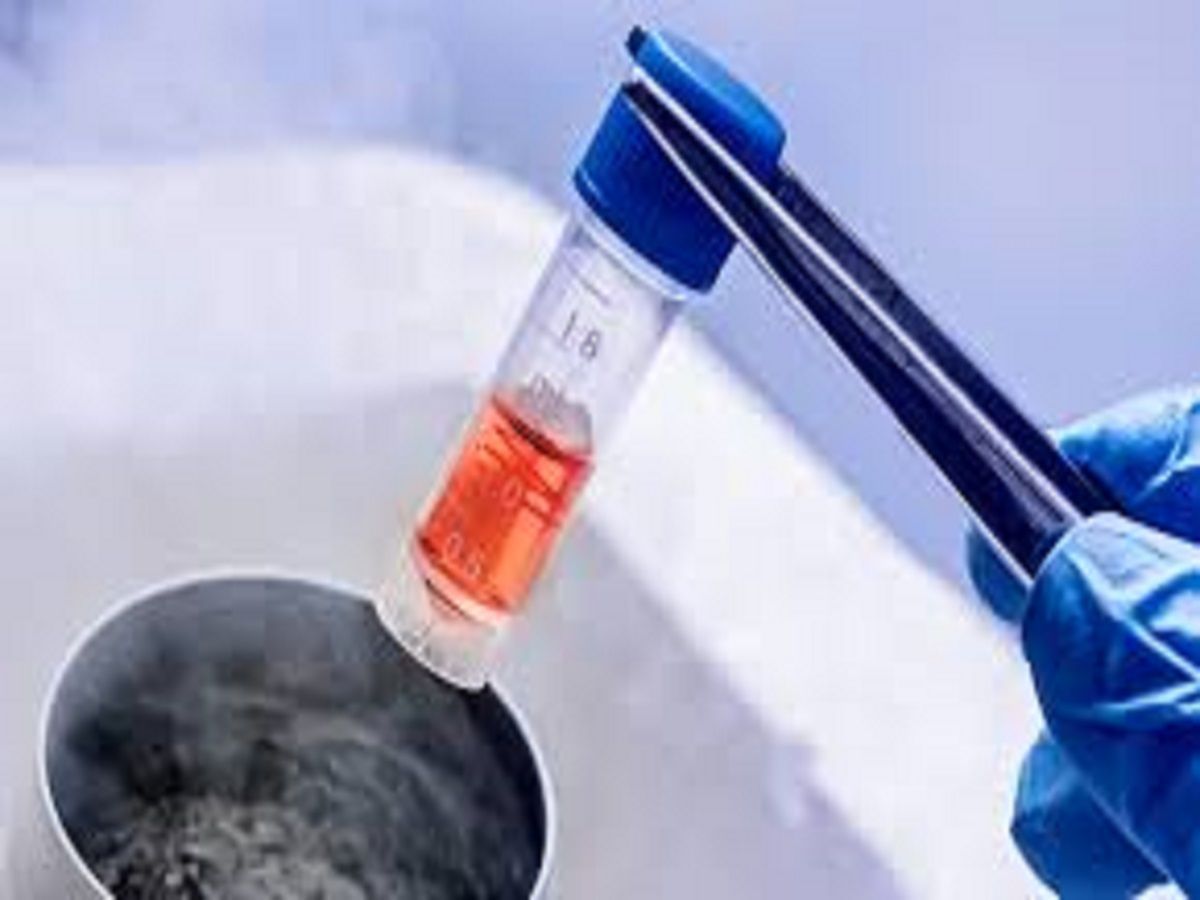 Serum-Free Freezing Media Market Industry Analysis Till 2028
