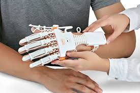 Smart Portable Rehabilitation Devices Market Forecast to 2028
