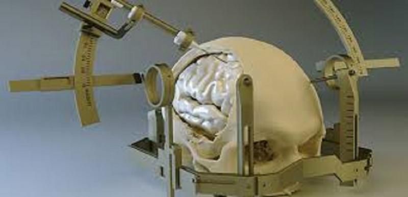 Stereotactic Surgery Devices Market Growth & Global Forecast 2028