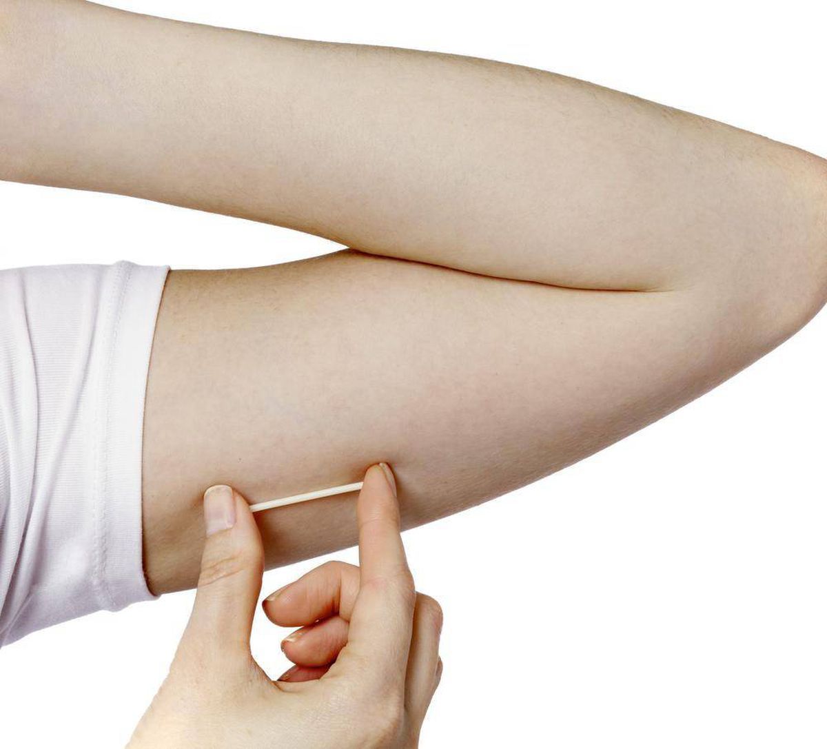 Subdermal Contraceptive Implants Market Share - Industry Report 