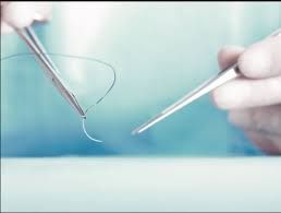 Surgical Sutures Market Growth | Research Report, 2028