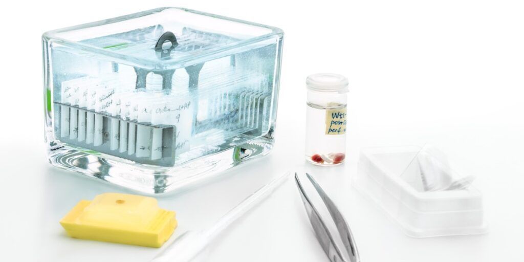 Tissue Fixation Market 2022: Forecast to 2028