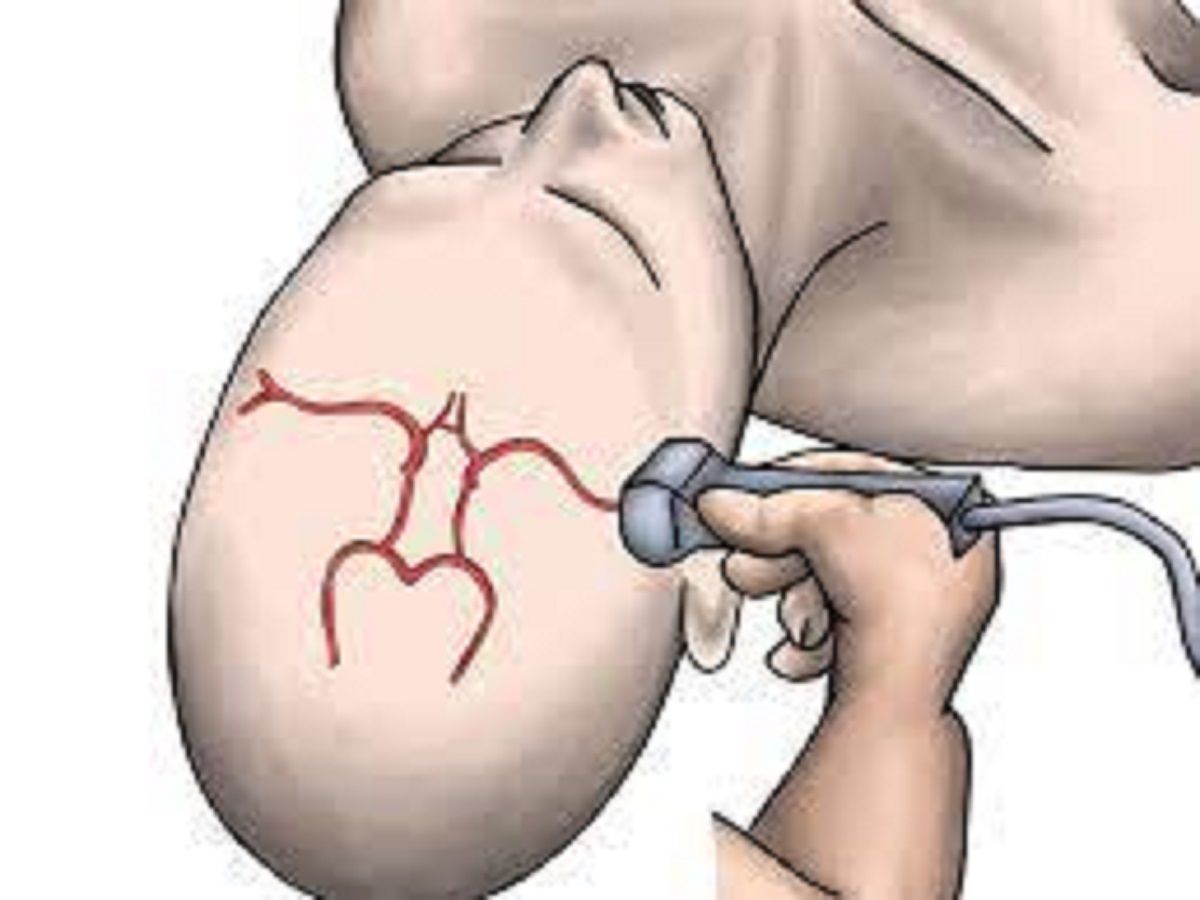 Transcranial Doppler Market Players, Forecast Report to 2028
