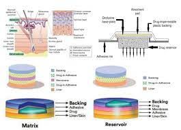 Transdermal Drug Delivery Systems Market Outlook, to 2028