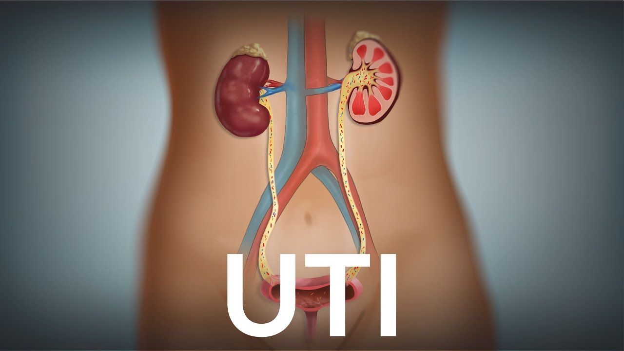 Meet Your Local Urologist in Dyer: Dr. Expertise