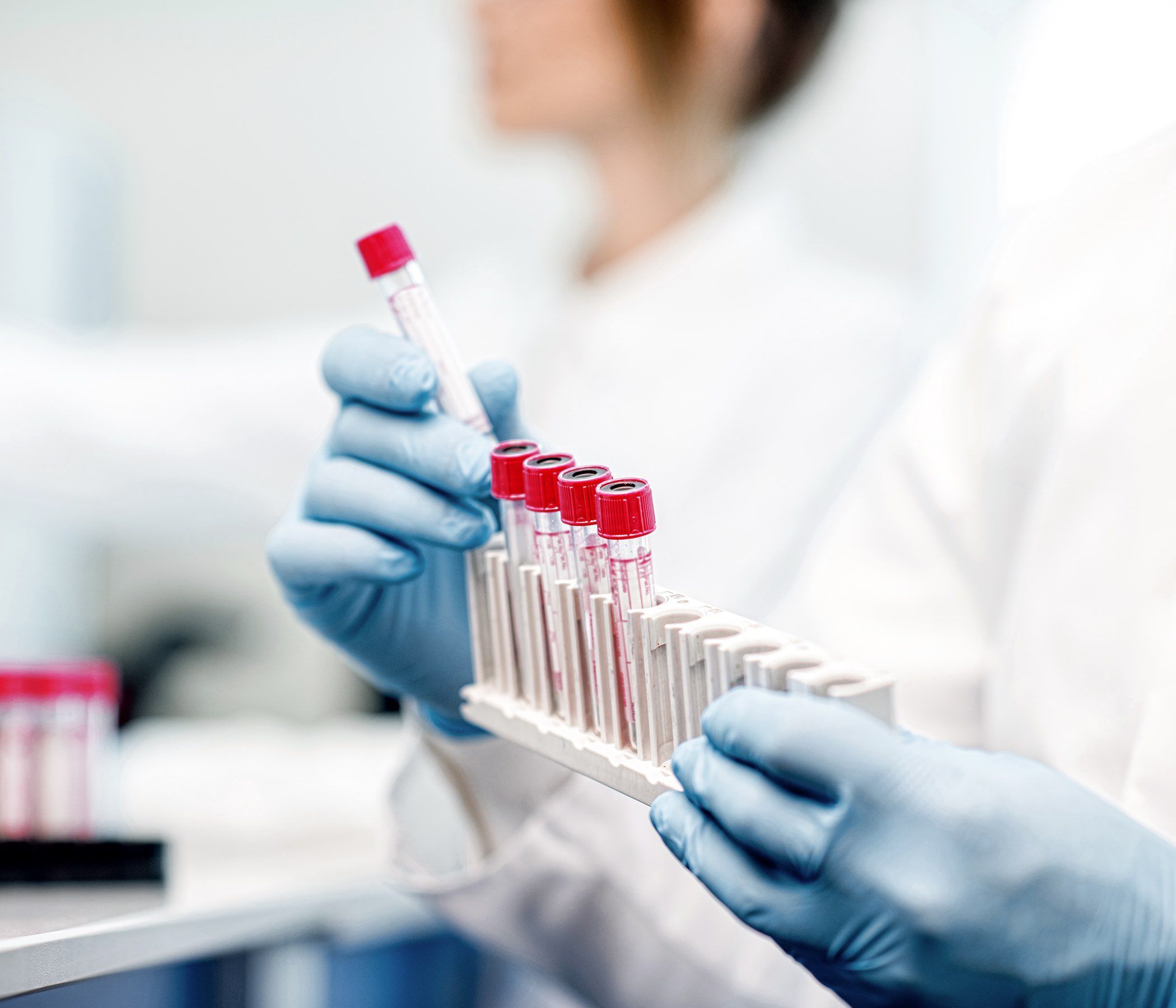 Urinalysis Market Report, 2022-2028 | Growth, Trends and Forecast