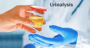 Urinalysis Market 2022 Size, Dynamics & Forecast Report to 2028

